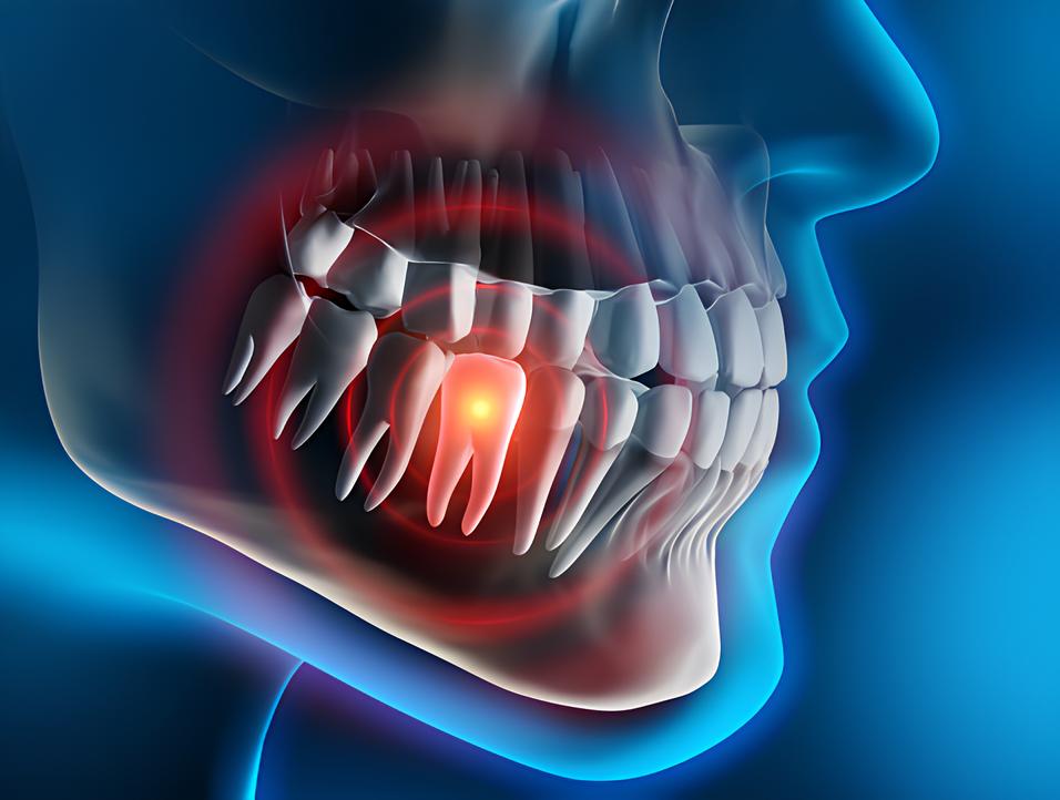 Teeth image - Emergency dentist Haslemere